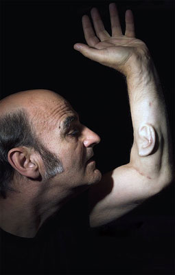 stelarc-ear.jpg